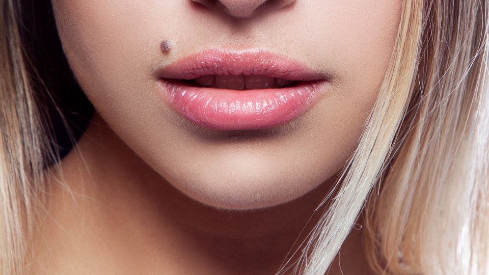 Beauty Spots (2)