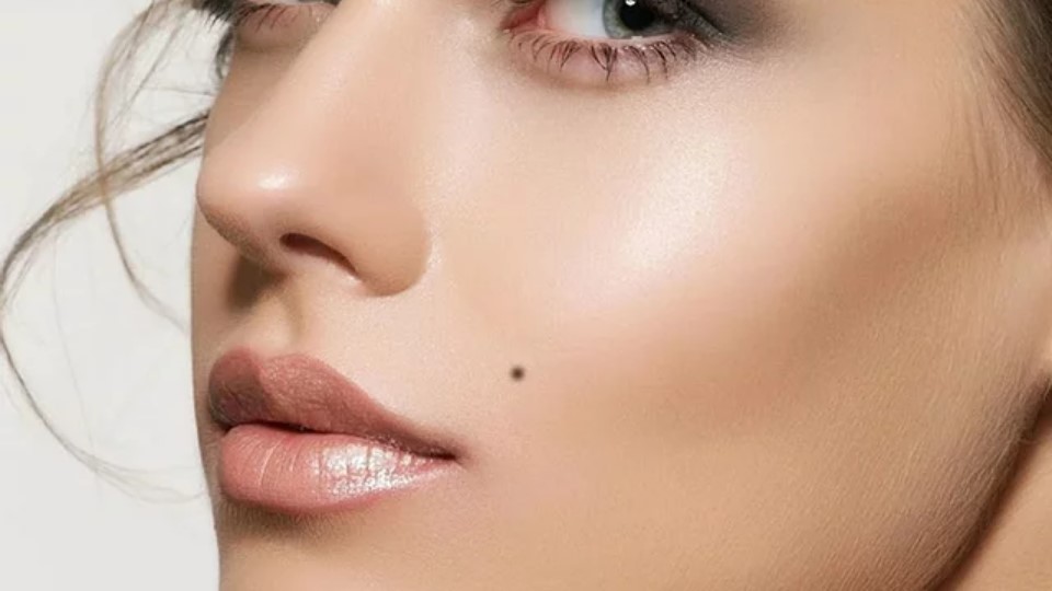 Beauty Spots