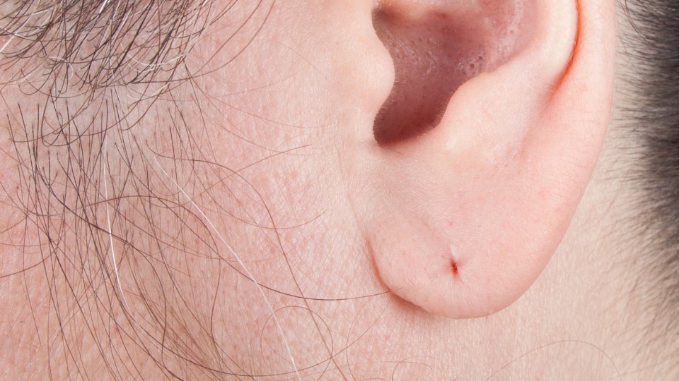 Ear Lobe Piercing (1)