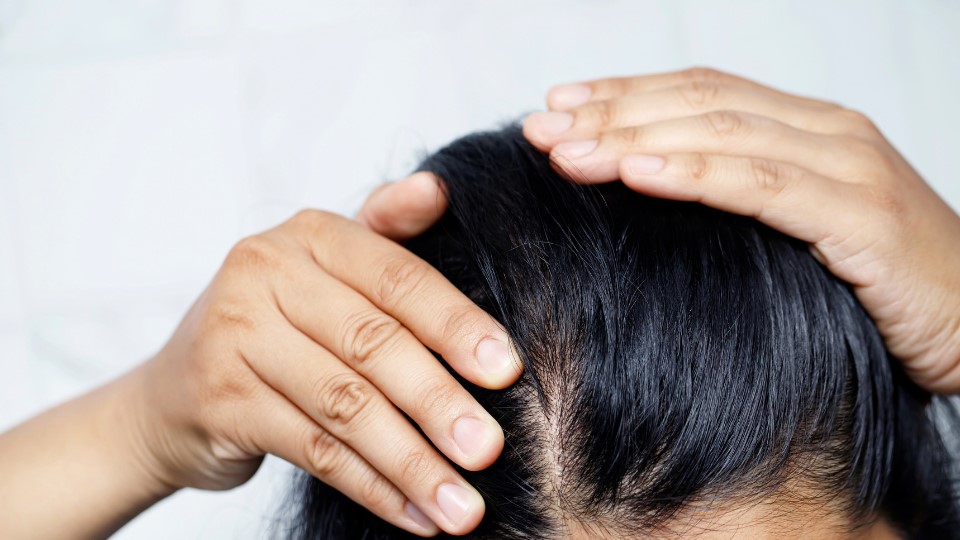 Scalp (1)