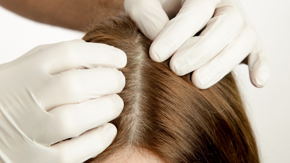 Scalp